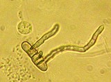 Tremella obscura image