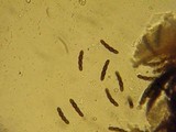 Sporormiella australis image
