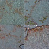 Lecanora albella image