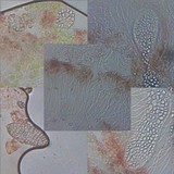 Phlyctis agelaea image