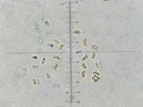 Lepiota trichroma image
