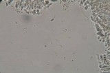 Typhula phacorrhiza image