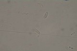 Typhula phacorrhiza image