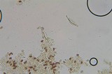Psathyrella longistriata image