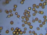 Disciseda cervina image