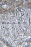 Myriolecis hagenii image