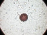 Scleroderma cepa image