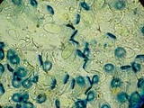 Peziza vesiculosa image