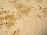 Coprinopsis semitalis image