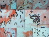 Parasola conopilea image