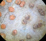 Badhamia rubiginosa image