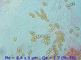 Stropharia coronilla image
