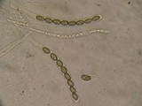 Bulgariella pulla image