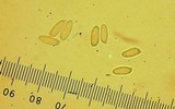 Suillus brevipes image