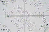 Hericium alpestre image