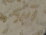Inocybe hotsoniana image