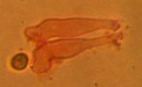 Atheniella leptophylla image