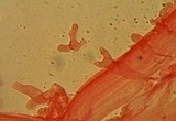 Atheniella leptophylla image