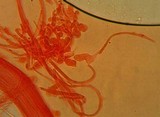 Atheniella leptophylla image