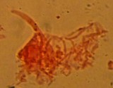 Atheniella leptophylla image