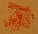 Atheniella leptophylla image