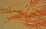 Mycopan scabripes image
