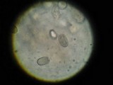 Hygrocybe acutoconica image