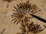 Sordaria fimicola image