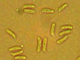 Tectella patellaris image