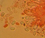 Mucronella bresadolae image
