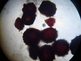 Nectria pseudotrichia image
