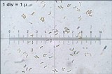 Tectella patellaris image