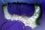 Pertusaria saximontana image