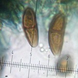Buellia chloroleuca image
