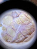 Gibberella zeae image