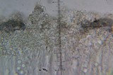 Lecanora juniperina image