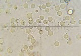 Amanita xylinivolva image