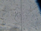Hypomyces armeniacus image