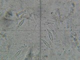 Hypomyces armeniacus image