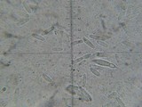 Hypomyces armeniacus image