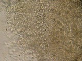 Phlebia livida image