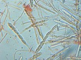 Microglossum olivaceum image