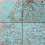 Trapelia coarctata image
