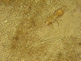 Hyphodontia cineracea image
