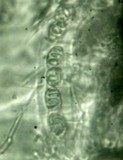 Pyrenula mamillana image
