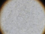 Coprinellus flocculosus image