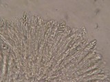 Hymenoscyphus imberbis image