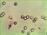 Pluteus chrysophlebius image