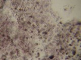 Tremella moriformis image