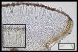 Cliostomum griffithii image